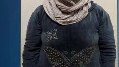  طفلة مستشفى الحسين 
