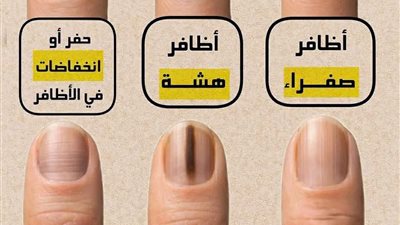 الاظافر