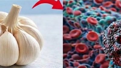  متي يصبح الثوم 