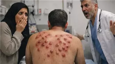 وجدتُ ثلاثين بقعة حمراء على ظهر زوجي تشبه بيض الحشرات