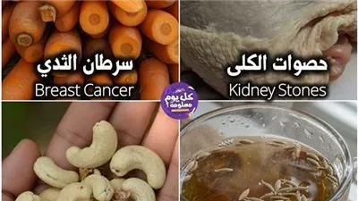 معلومات طبية