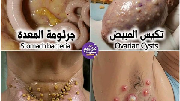 لمحة نيوز