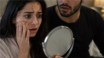 مرض مراتي حكايات زهرة 