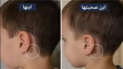 ابني وابن أقرب صاحبة ليا اتولدوا بنفس الوحمة حكايات صابرين محمد