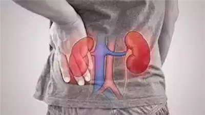 طريقك المباشر للفشل الكلوي.. احذر طعام شائعه يعشقه الملايين