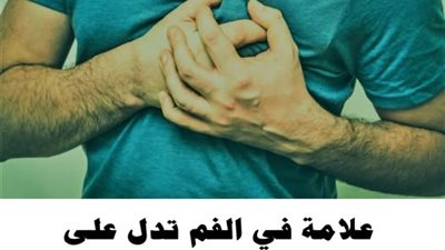 أطباء يحذرون علامة في الفم تنذر بقرب إصابتك بأزمة قلبية