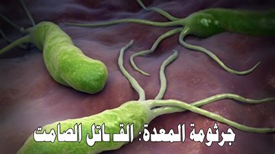 3 علامات في فمك تشير إلى الإصابة بجرثومة المعدة كيف تحمي نفسك