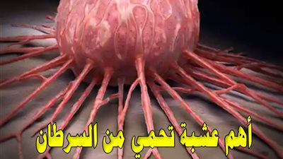 طبيب روسي يكشف عن أهم عشبة تحمي من السرطان موجودة في كل مطبخ