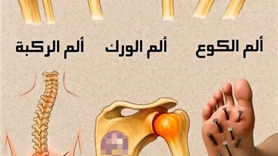  ألم الكوع بسبب مشاكل الأعصاب والأربطة