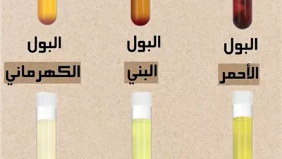  البـول الأحمر جفاف حـاد البـول البني جفاف شديد