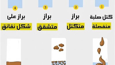 كتـل صـلبة منفصلة : إمسـاك شديد